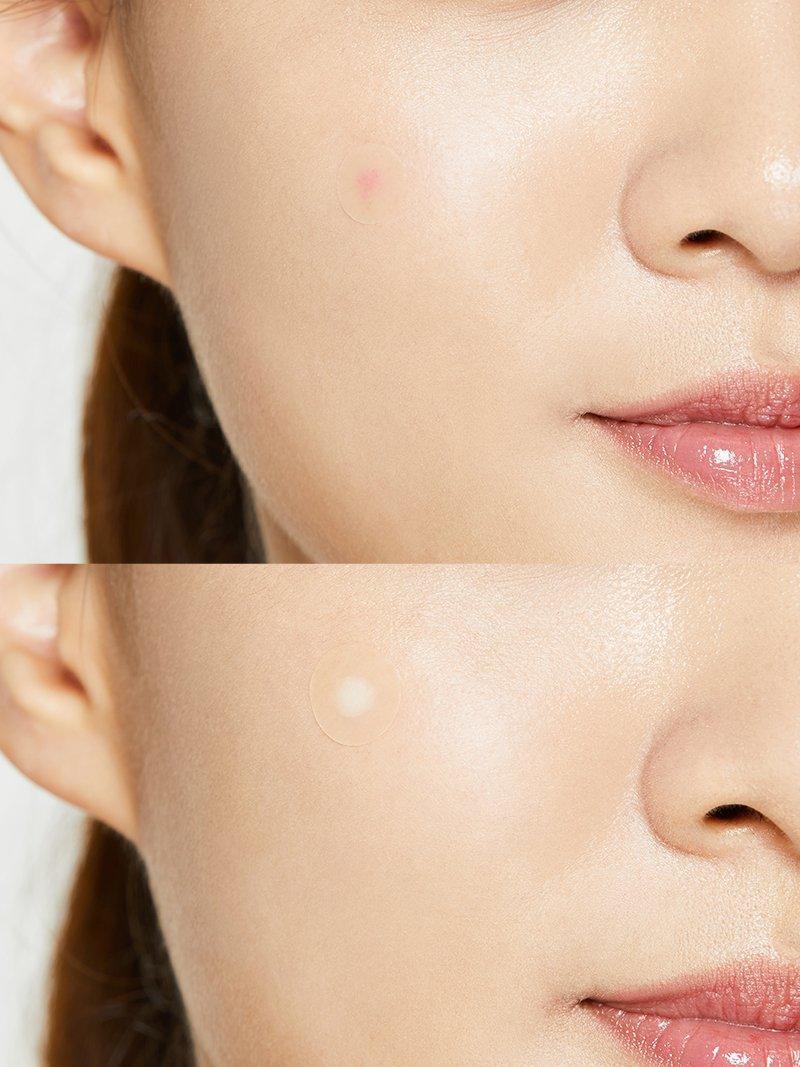 COSRX Acne Pimple Master Patch (24 patches)